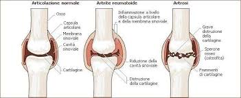 PATOLOGIE GERIATRICHE E APPROCCIO OSTEOPATICO: Unknown -