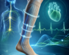 Terapia compressiva e variabilità della frequenza cardiaca con focus su sistema nervoso autonomo e circolazione